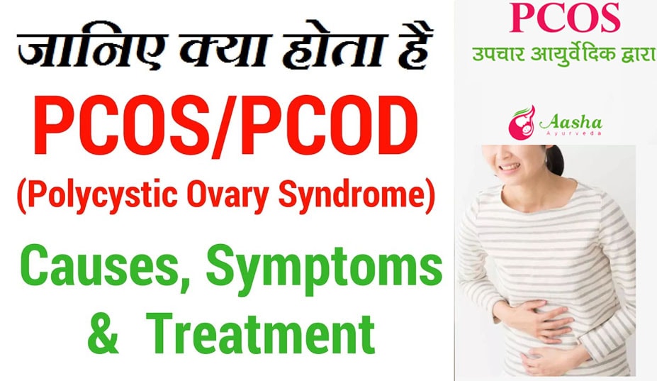 What is Polycystic Ovary Syndrome (PCOS) - Symptoms, Causes and Treatment, PCOD Doctors?