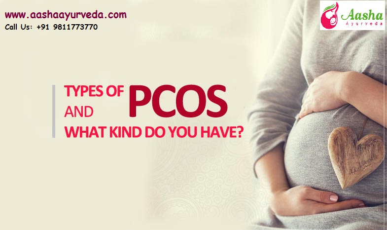 Types Of Pcos And What Kind Do You Have?