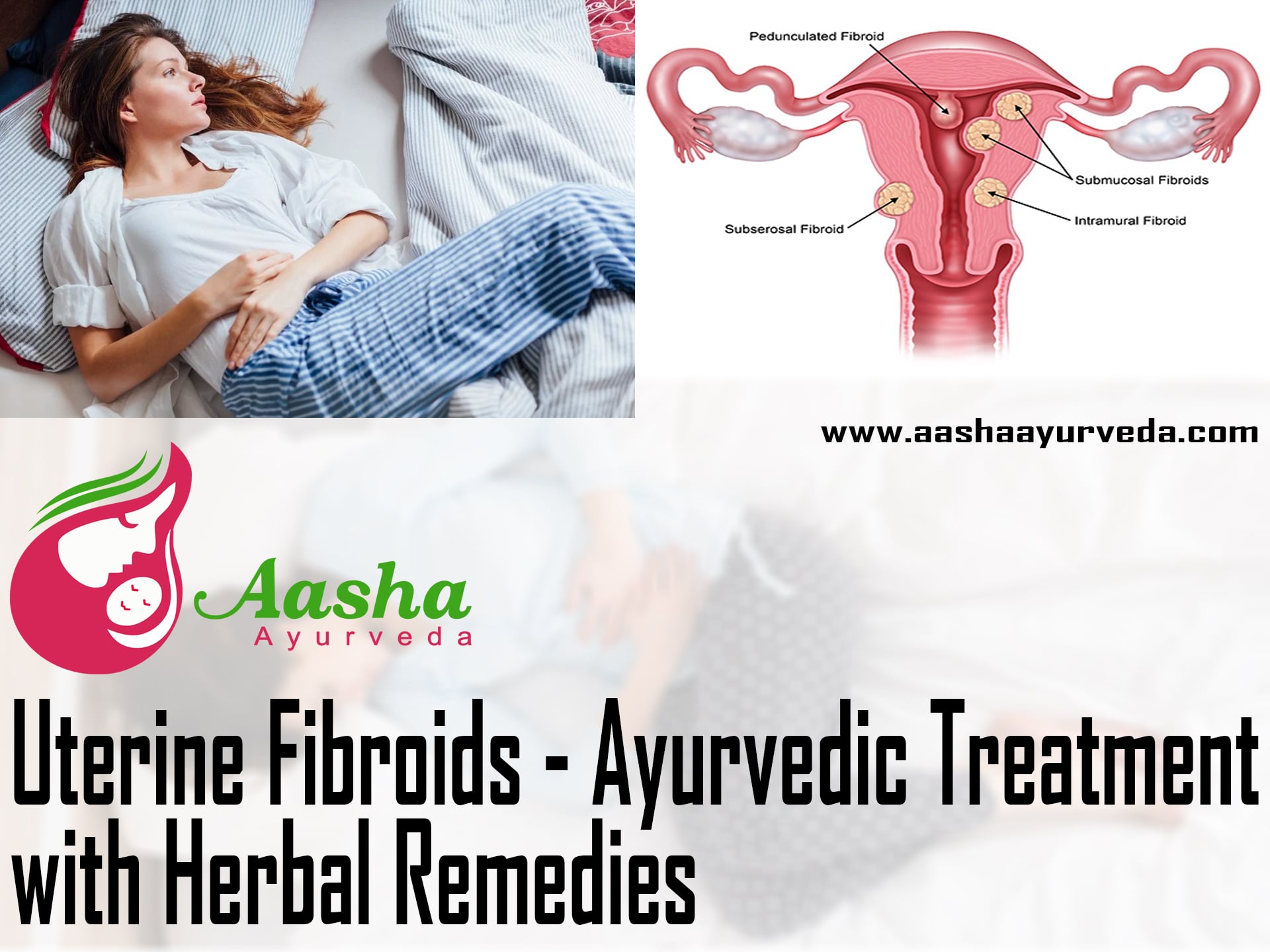 Uterine Fibroids - Ayurvedic Treatment with Herbal Remedies 