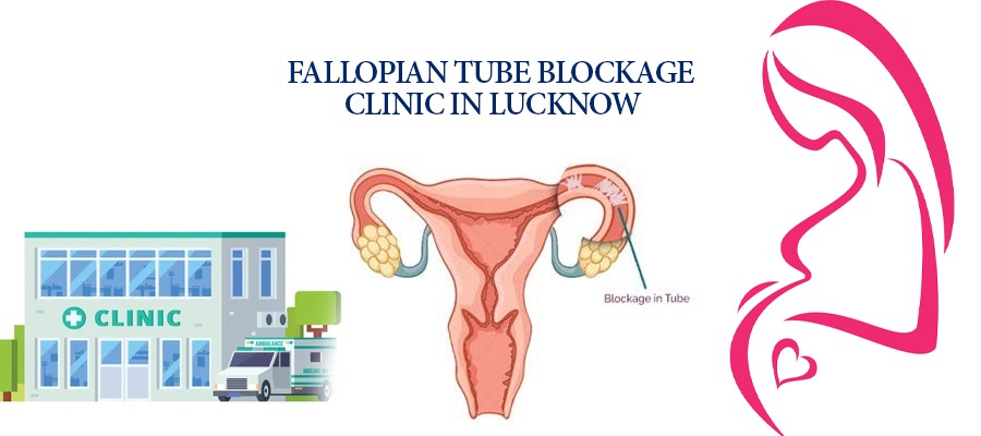 Top Fallopian Tubes Blockage Treatment Center in Lucknow