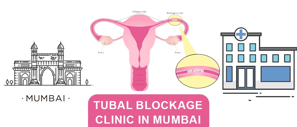 Best Fallopian tube blockage Clinic in Mumbai Maharashtra