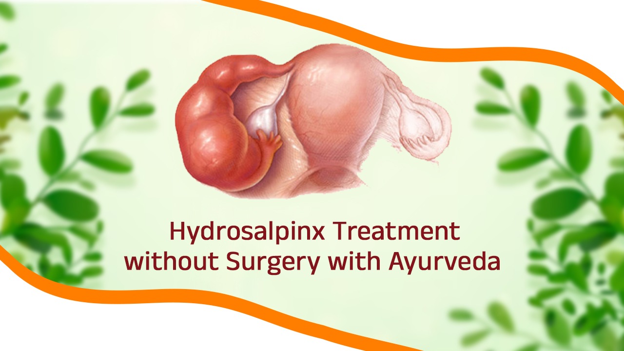 Hydrosalpinx Treatment without Surgery with Ayurveda