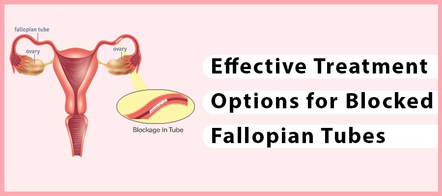 Ayurvedic Treatment for Blocked Fallopian Tubes – Aasha Ayurveda Dr Chanchal Sharma