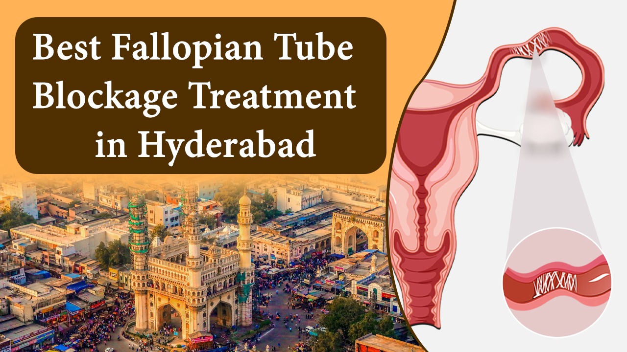 Best Treatment for Fallopian Tube Blockage in Hyderabad – Tubal Blockage Treatment in Hyderabad, Telangana